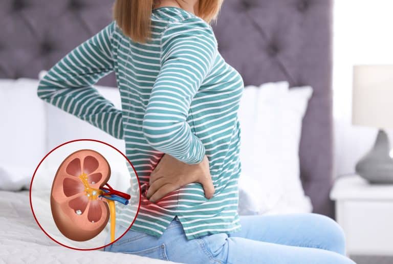 Mi oldja a vesekövet? Természetes gyógymódok